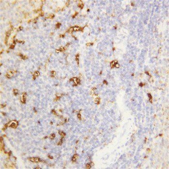 Anti-Alpha Amylase 1/AMY1A Antibody