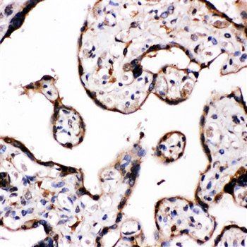 Anti-Aromatase/CYP19A1 Antibody