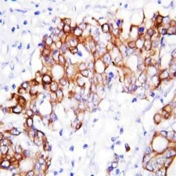 Anti-GCLC Antibody