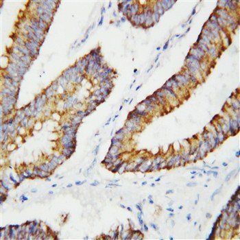 Anti-BCAT2 Antibody