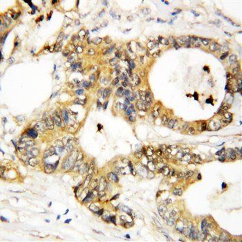 Annexin A3/ANXA3 Antibody