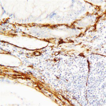 Anti-Caveolin-1/CAV1 Antibody