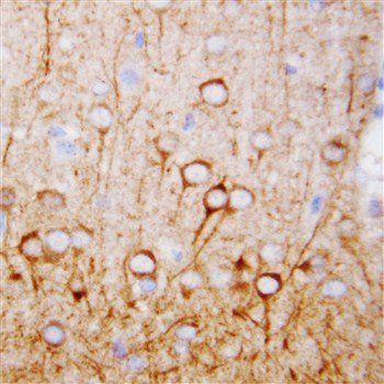 Anti-CaMKK/CAMKK1 Antibody