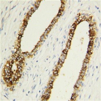 Caspase-1(P10)/CASP1 Antibody