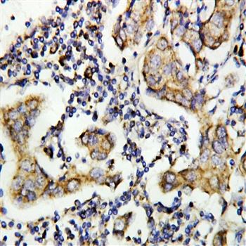 Anti-Caspase-8(P10)/CASP8 Antibody