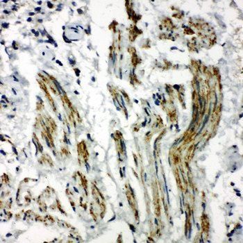 Anti-Caveolin-2/CAV2 Antibody