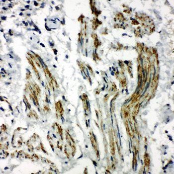 Caveolin-2/CAV2 Antibody