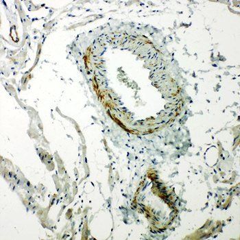 Anti-Caveolin-2/CAV2 Antibody