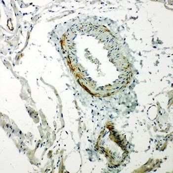 Caveolin-2/CAV2 Antibody