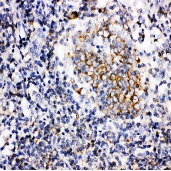 Anti-BAFF/TNFSF13B Antibody