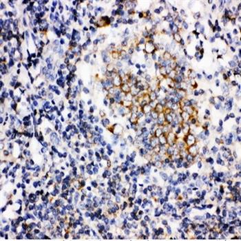 BAFF/TNFSF13B Antibody