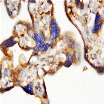 Anti-EPO/Erythropoietin Antibody