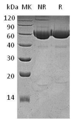 Human Legumain protein