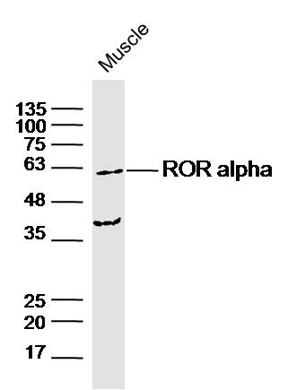 ROR Alpha antibody