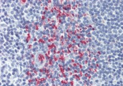 OCIL antibody