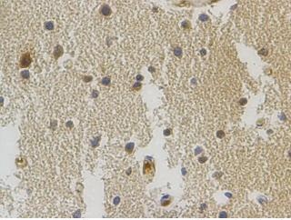 COL24A1 Rabbit Polyclonal Antibody