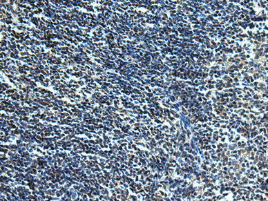 SLC2A12 Antibody