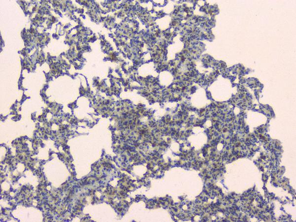 SLC34A2 Antibody
