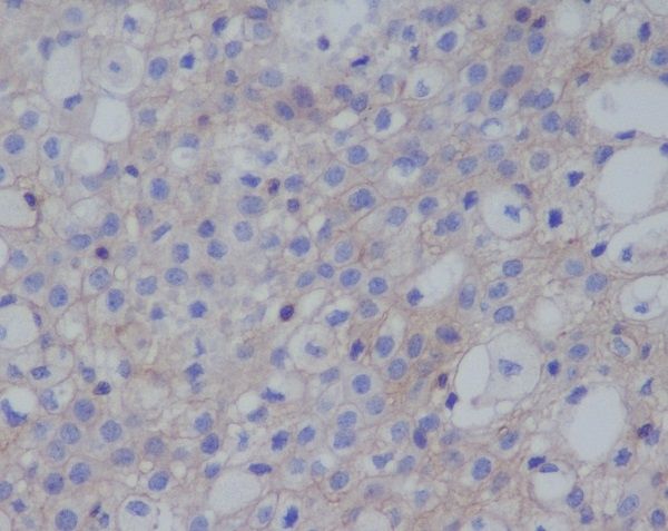 PD-L1 (CD274) Rabbit Monoclonal Antibody