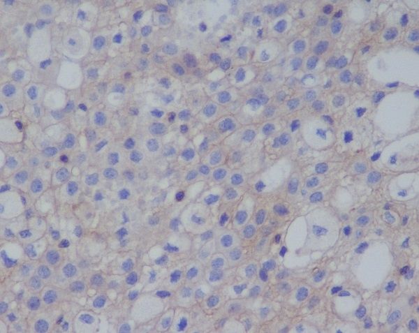 Anti-PD-L1 (CD274) Rabbit Monoclonal Antibody
