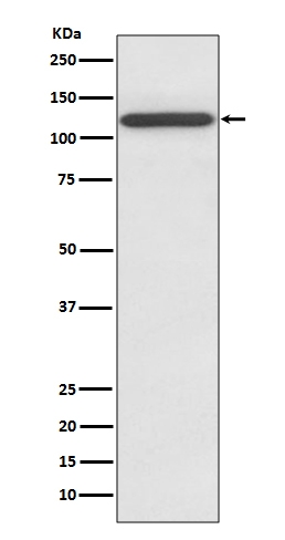 NMDAR1 GRIN1 Rabbit Monoclonal Antibody
