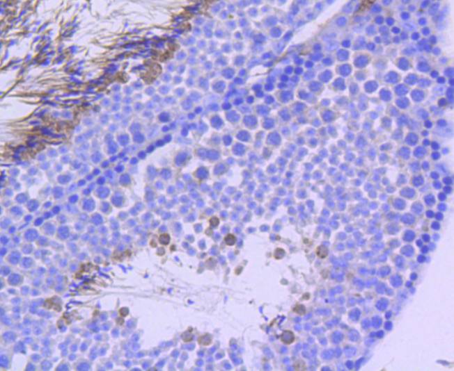 p95/NBS1 (Phospho-S343) Antibody