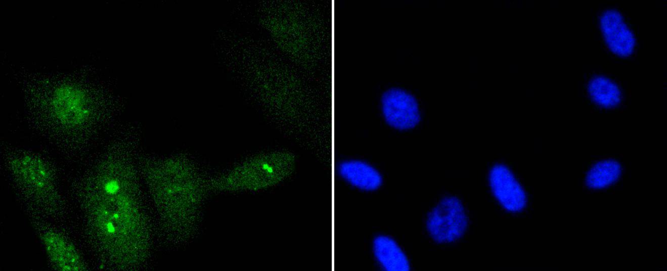 p95/NBS1 (Phospho-S343) Antibody