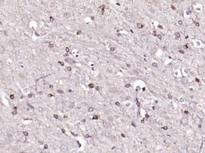 HMGCR (phospho-Ser872) antibody