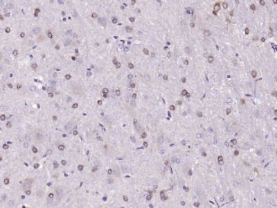 HMGCR (phospho-Ser872) antibody