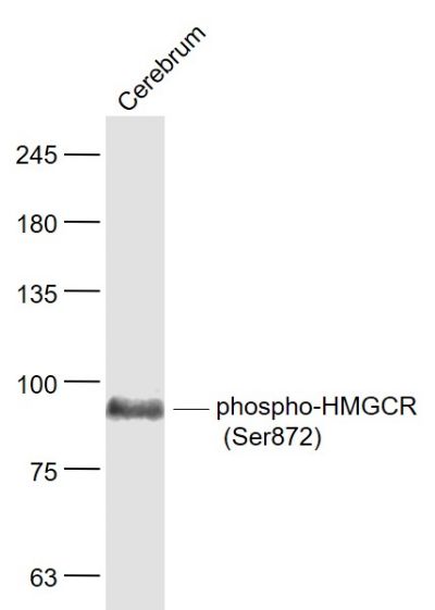 HMGCR (phospho-Ser872) antibody