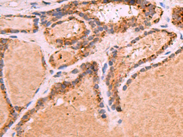 GPC2 Antibody