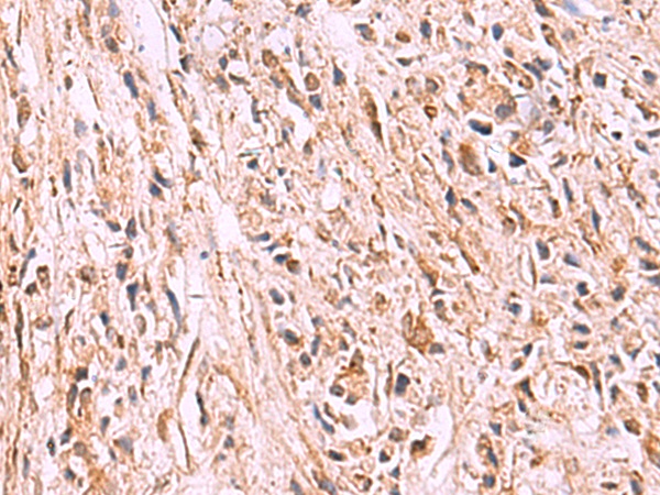 GPC2 Antibody