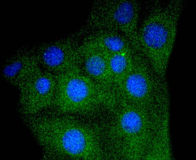 Myoglobin Antibody