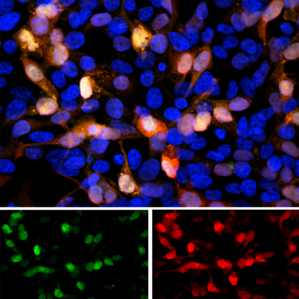 Green Fluorescent Protein (GFP) Antibody