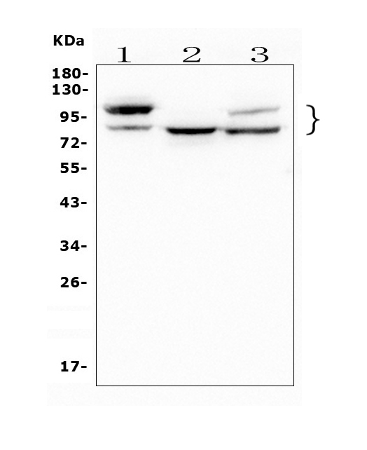 GAA Antibody (monoclonal, 2G7)