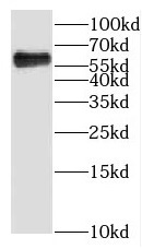 KLHL31 antibody