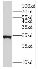 RPL21 antibody