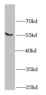 SGCE antibody