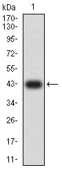 KMT2D Antibody