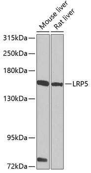 LRP5 polyclonal antibody