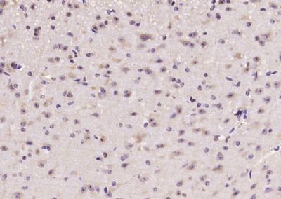 mTOR (phospho-Ser2481) antibody