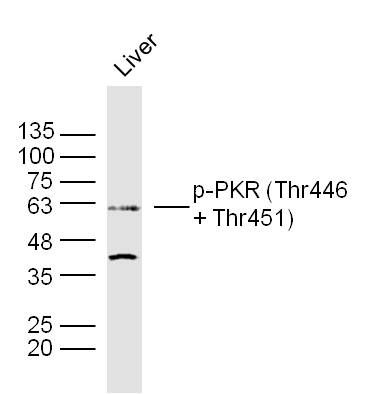 PKR (phospho-Thr446/451) antibody