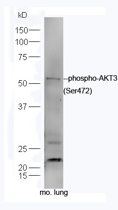AKT3 (phospho-Ser472) antibody