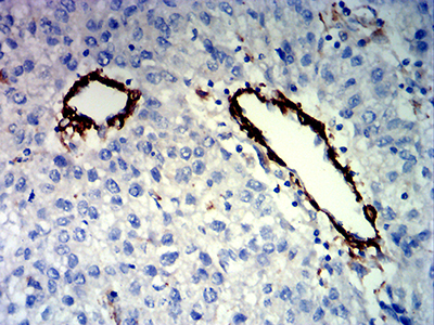 FLI1 Antibody