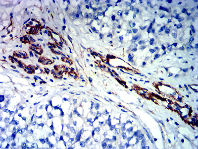 FLI1 Antibody