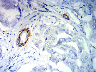 FLI1 Antibody