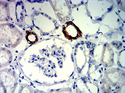 FLI1 Antibody