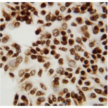 C-terminal-binding protein 2 CTBP2 Antibody
