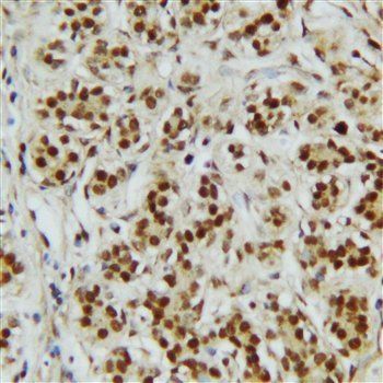 C-terminal-binding protein 2 CTBP2 Antibody