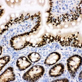 C-terminal-binding protein 2 CTBP2 Antibody